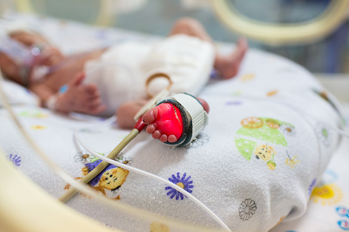 premture infant in the NICU